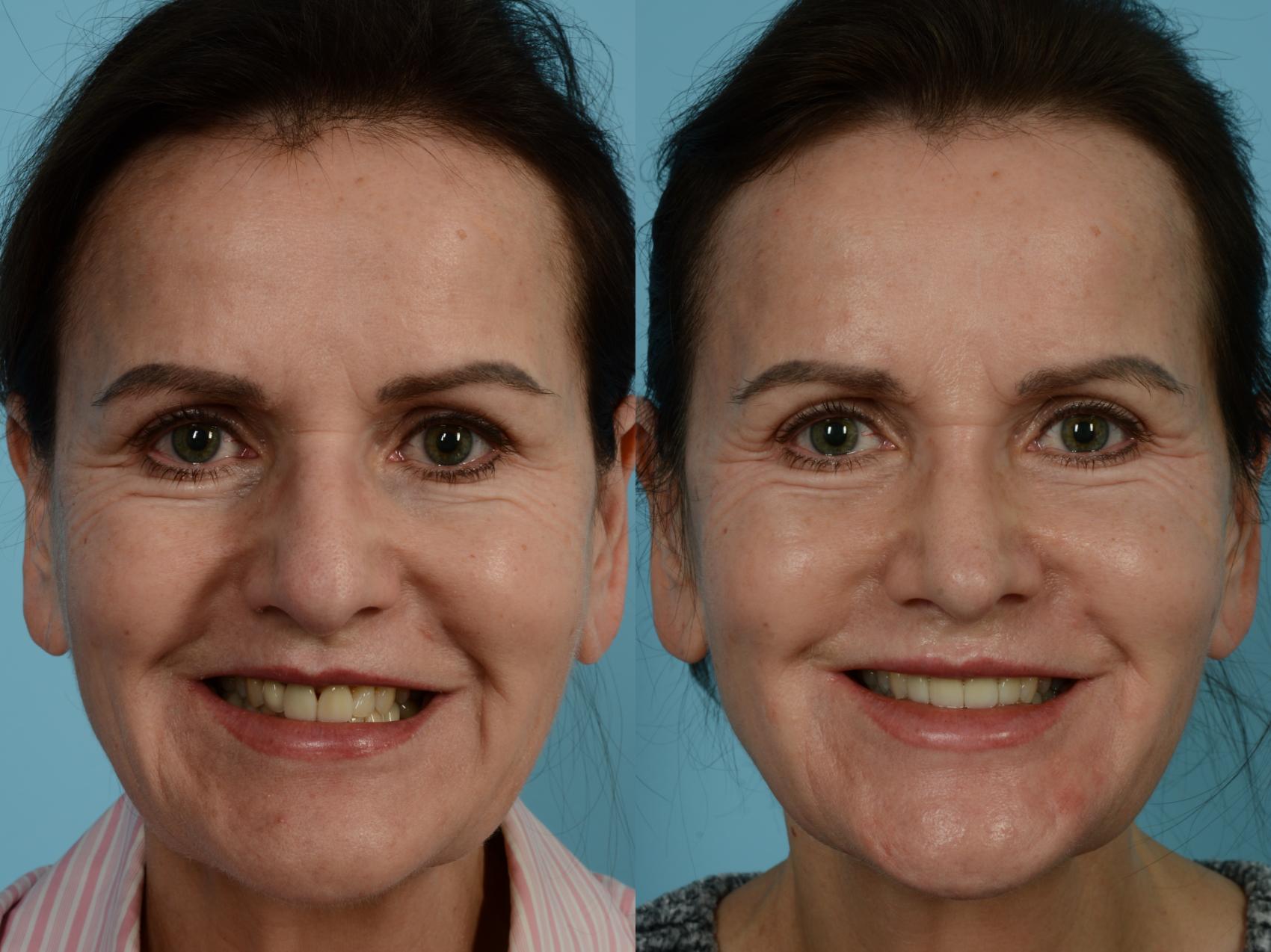 Dr. Sinno Rhinoplasty in Chicago, Illinois